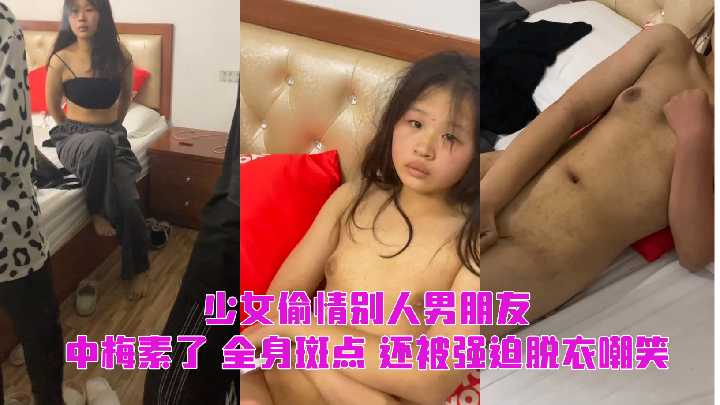 少女偷情别人男朋友，中梅素了 全身斑点 还被强迫脱衣嘲笑